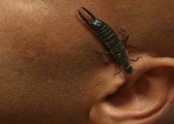 Cách xử lý kiến hoặc côn trùng chui vào tai